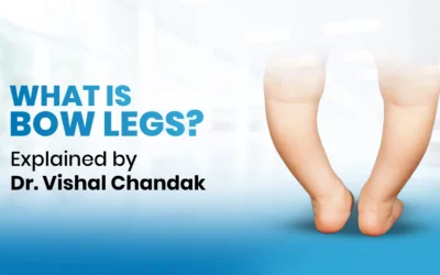 What is Bow Legs | Explained by Dr. Vishal Chandak
