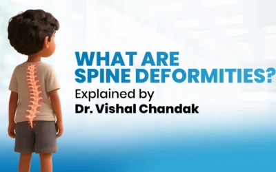 What is Spine Deformities | Explained by Dr. Vishal Chandak